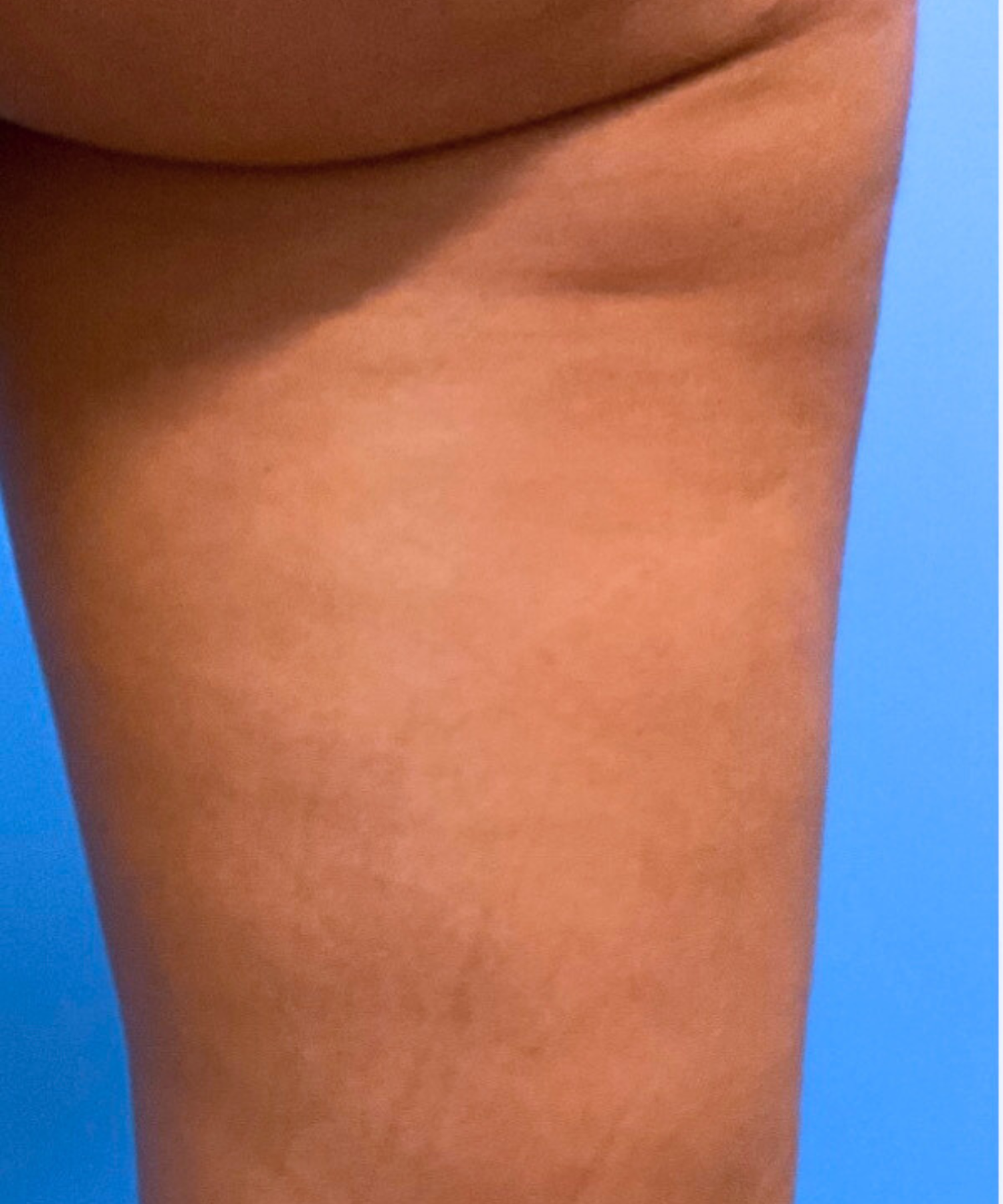 Before Image: Venus Legacy - front