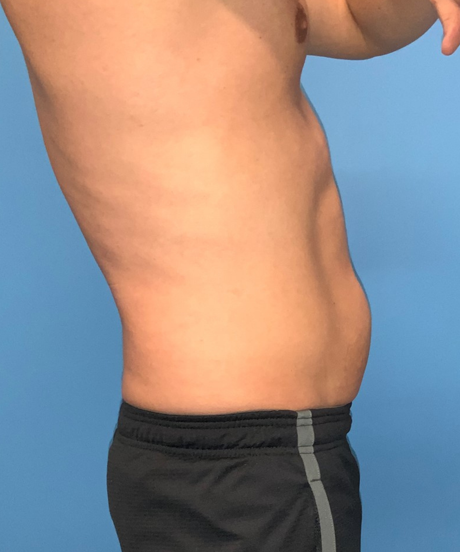 After Image: CoolTone - right-side