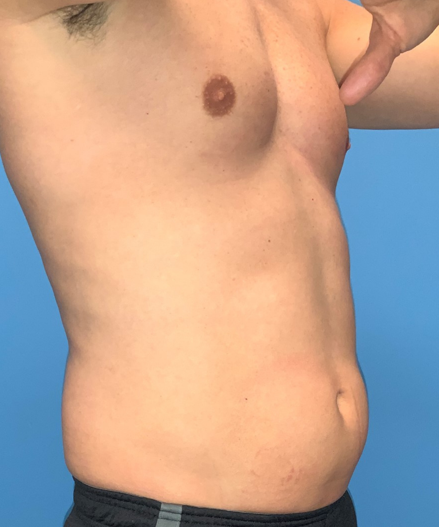 After Image: CoolTone - right-front-oblique